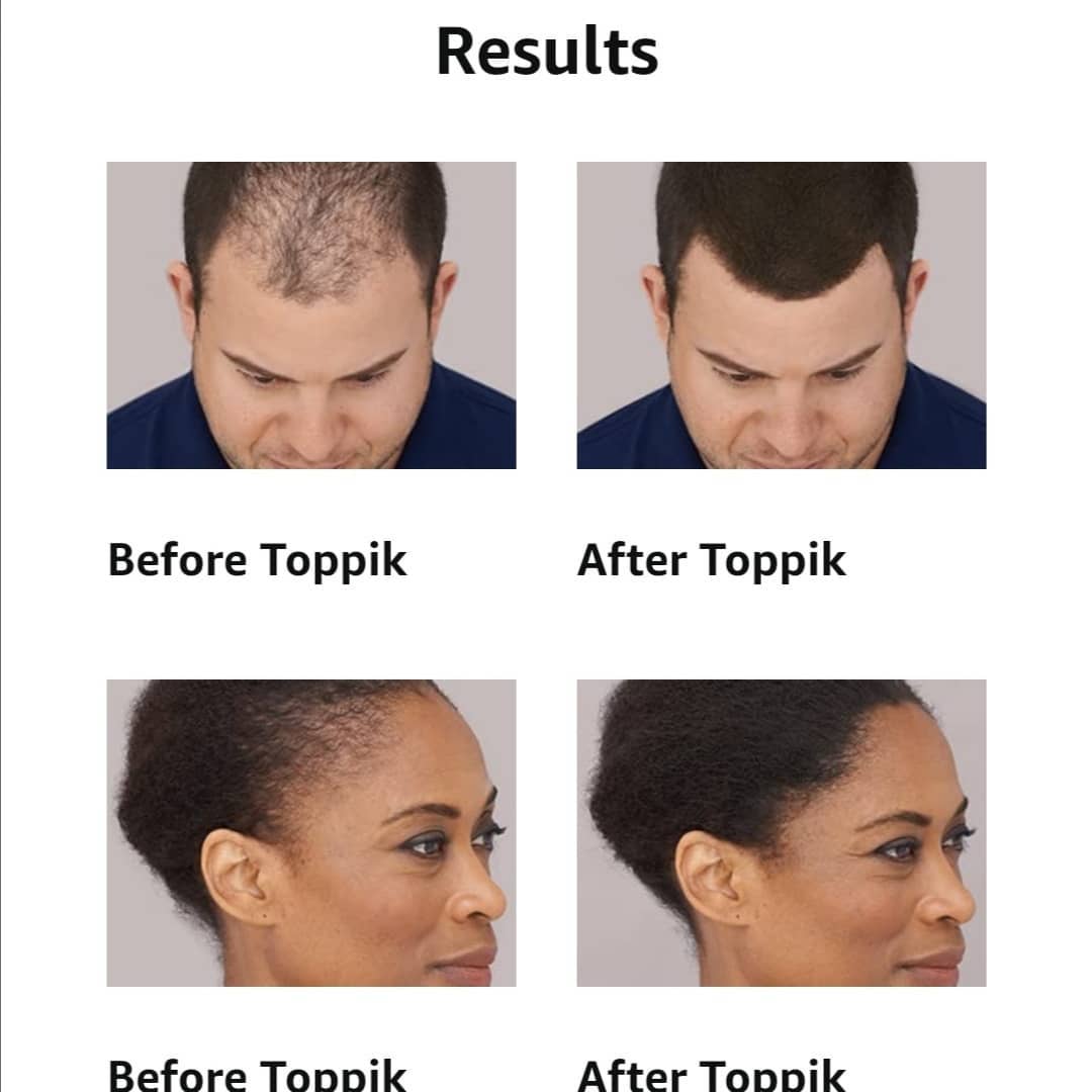 Toppik Fibra Capilar