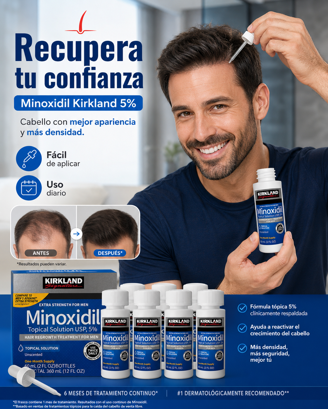 Kirkland Minoxidil 5% - Pack 6 en 1