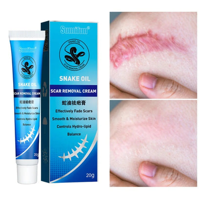 Snake Oil Scar Removal Cream